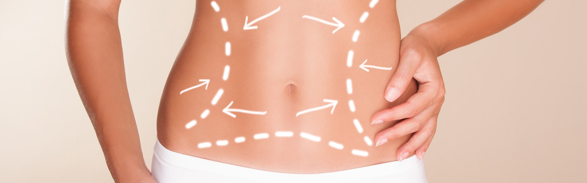 Abdominoplasty